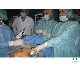 Laparoscopy Training in India