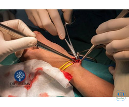 Best Dialysis Access & AV Fistula Doctor in Mumbai-Dr. Dharav Kheradia