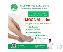 Best Varicocele Treatment Options