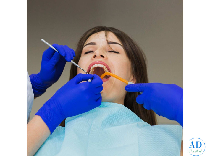 Long-Lasting Tooth-Colored Fillings Available in Ahmedabad