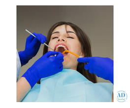 Long-Lasting Tooth-Colored Fillings Available in Ahmedabad