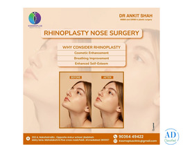 Advanced Rhinoplasty in Ahmedabad with Expert Care at Kosmoplus