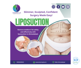 Ahmedabad’s Best Liposuction Surgery for Quick Recovery: Kosmoplus