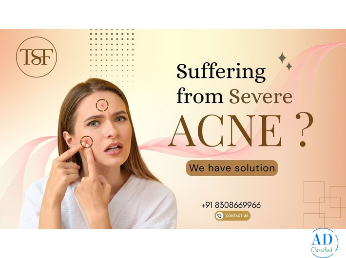 Best Skin Specialist & Dermatologist in Pune – The Skin Firm | Kondhwa & Mohammed Wadi