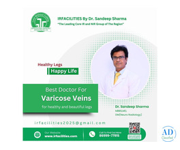 Best Options for Varicose Vein Treatment